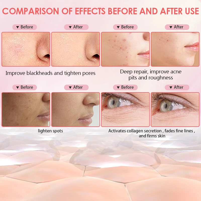 Red Light therapy 7 Color Led Face Mask, Therapy Facial,SkinCare Beauty,Anti Aging Skin Rejuvenation Shrink Pores,Facial Lifting - Image 6